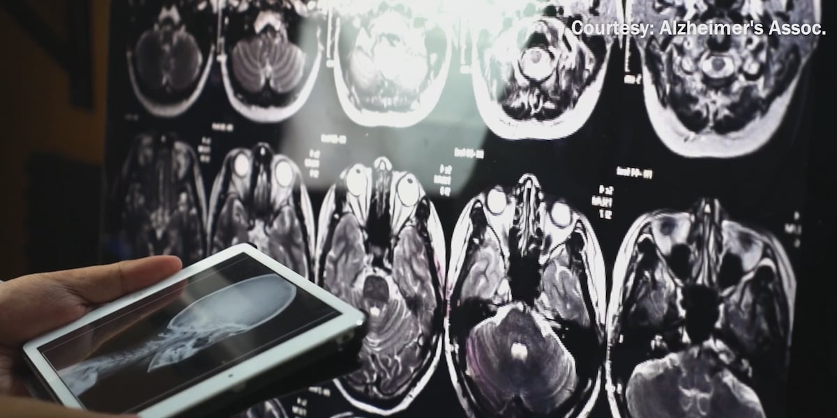 Boost Your Brainpower: Simple Lifestyle Changes That Make a Big Difference