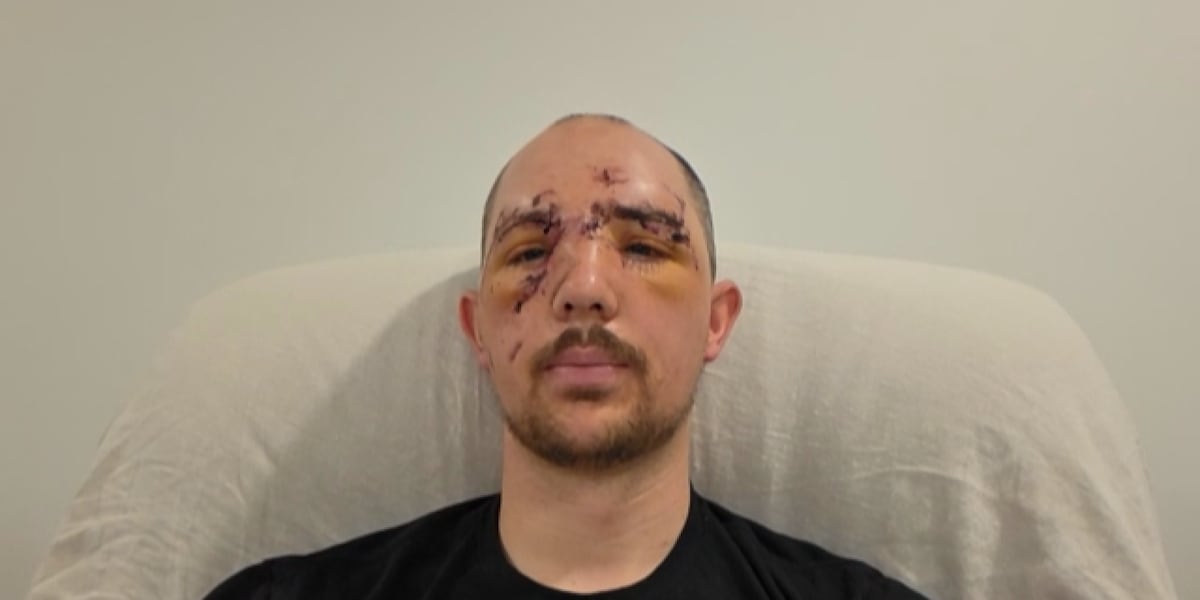 Father bitten in face by bear during hunting trip: ‘I could hear all the bones crunching’