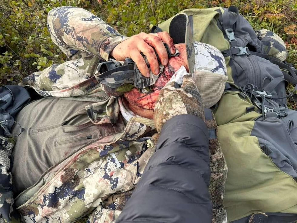 Father bitten in face by bear during hunting trip: ‘I could hear all the bones crunching’